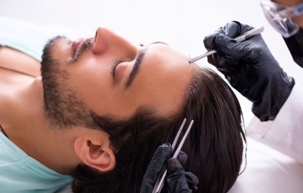 What To Expect In A Hair Transplant Procedure 